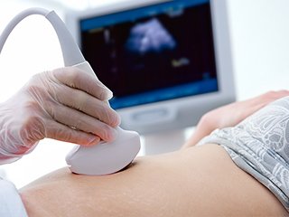 フロー_A_06 イメージ2